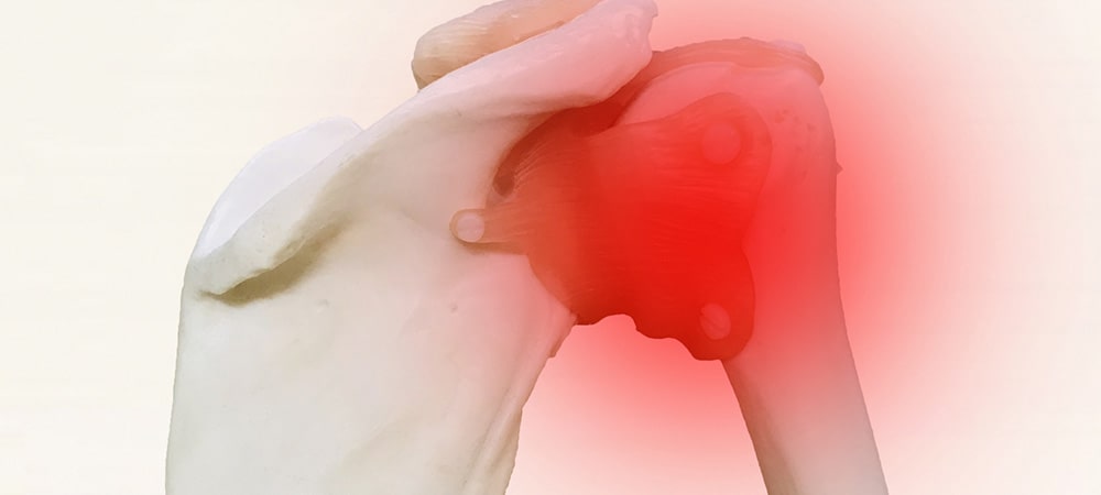 肩関節周囲炎（いわゆる五十肩）